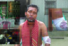 আড়াইহাজারে বাড়ির সদস্যদের বেঁধে বেধড়ক মারধর ও ডাকাতি